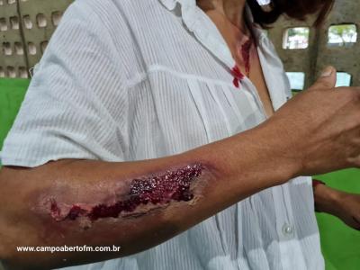 ManifestaÃ§Ã£o Contra a ViolÃªncia Ã s Mulheres teve de ser transferida devido ao mau tempo