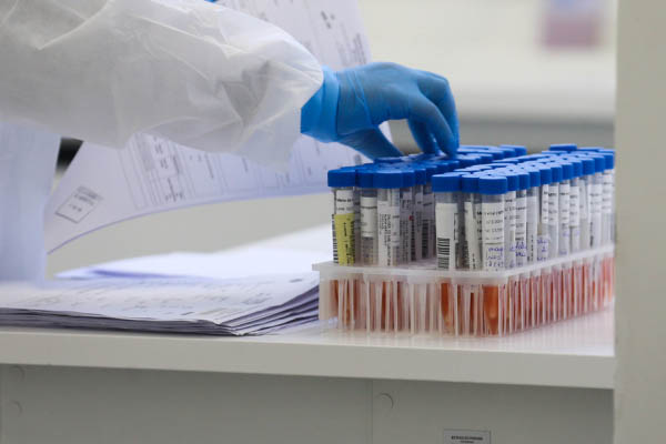 ParanÃ¡ descarta casos suspeitos da Ã”micron. 'VÃ­rus nÃ£o circula no Estado', diz Secretaria