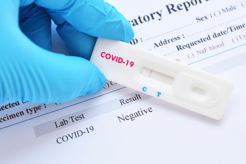 SEMUSA de Laranjeiras do Sul alerta populaÃ§Ã£o sobre atendimento da central de testes do Covid19