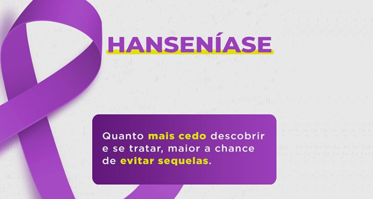 Campanha Janeiro Roxo reforça o combate a Hanseníase em Laranjeiras do Sul